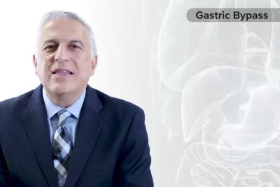 Procedure Overview: Gastric Bypass with Dr. Vafa Shayani
