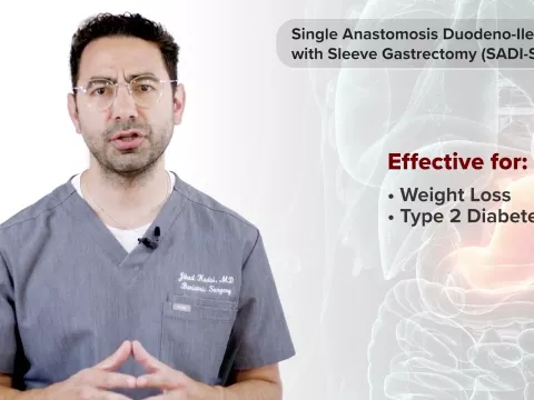 Single Anastomosis Duodeno-Ileal Bypass with Sleeve Gastrectomy (SADI-S) with Dr. Jihad Kudsi