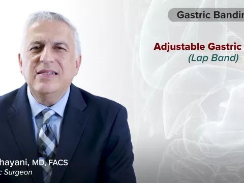 Procedure Overview: Gastric Banding (Lap Band) with Dr. Vafa Shayani