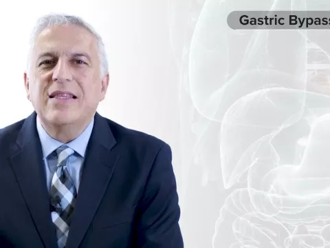 Procedure Overview: Gastric Bypass with Dr. Vafa Shayani