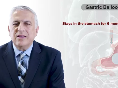 Procedure Overview: Gastric Balloon with Dr. Vafa Shayani